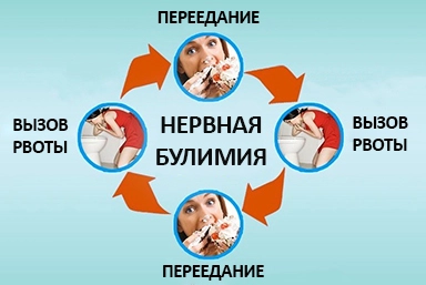 Лечение булимии в Нефтегорске